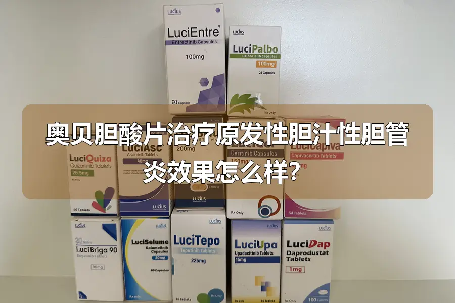 奥贝胆酸片治疗原发性胆汁性胆管炎效果怎么样?