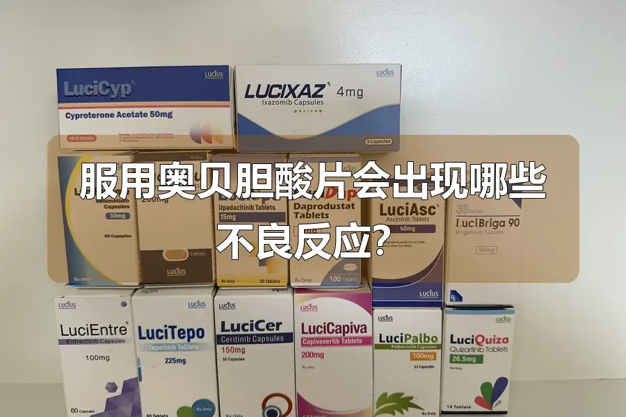 服用奥贝胆酸片会出现哪些不良反应?